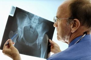 рентгенодиагностика наследственных системных заболеваний скелета