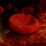 Гемолитическая анемия при системной красной волчанке