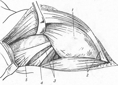 Малая ягодичная, грушевидная и запирательная мышцы с mm. gemelli