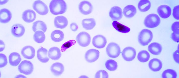 Plasmodium falciparum (фото) - являющийся возбудителем малярии