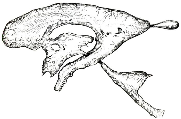 Вид сбоку на желудочки мозга (no Millen и Woollam)