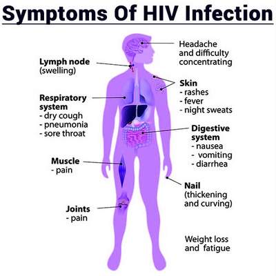 Симптомы ВИЧ