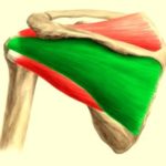 Боль в подостной мышце: лечение блокадой